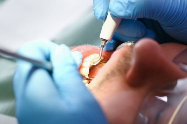 Best Root Canal Emergency Dentist  in Collinsburg, PA